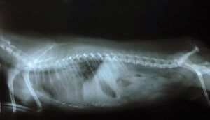 Zespół chwiejności: przyczyny, objawy i leczenie