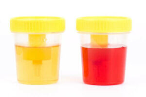 Hematuria u psów: obecność krwi w moczu