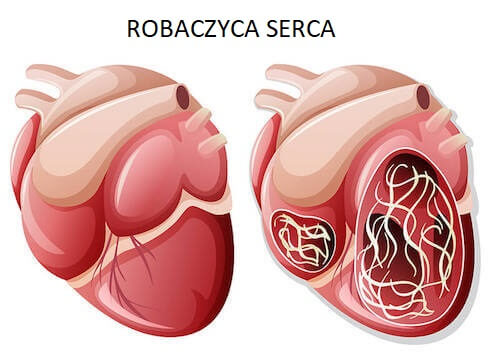 Robaczyca serca