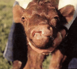 Rozszczep warg w u krowy, Wady wrodzone